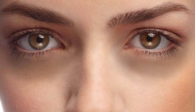 beauty benefits of potatoes,amazing beauty benefits of potatoes,potatoes beauty benefits,potatoes beauty,beauty,beauty tips,skin care tips