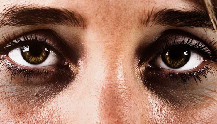 8 DIY Ways That Can Help in Keeping Dark Circles at Bay