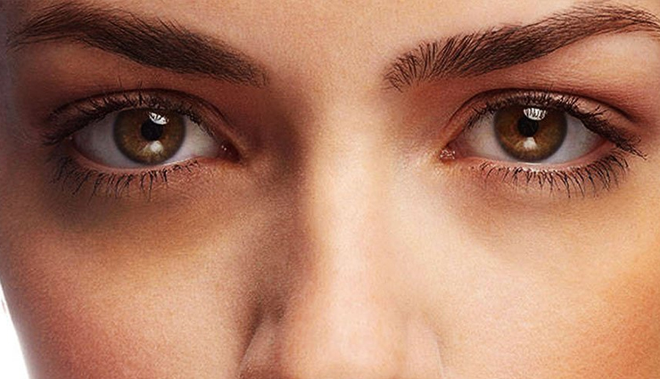 dark circles,causes of dark circles,skin care,dark circles problem,beauty,beauty tips