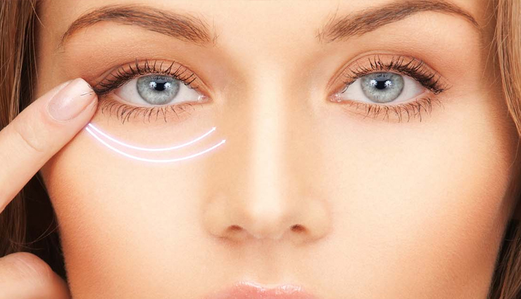 9 Home Remedies For Dark Circles And How To Use Them