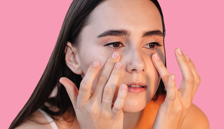 6 Tips To Get Rid of Dark Circles Permanently at Home
