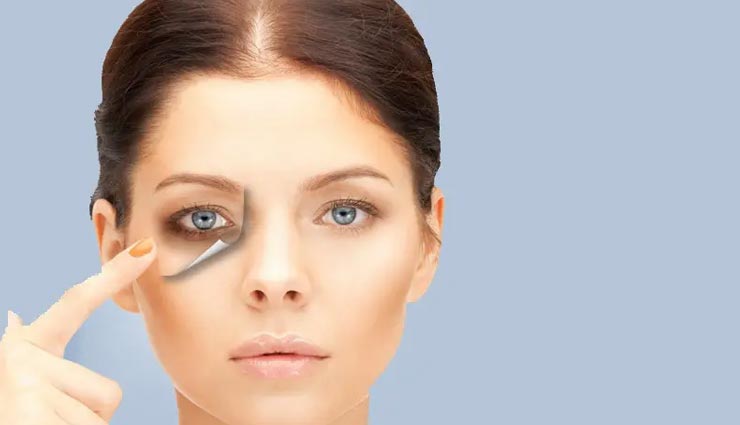 5 DIY Ways To Use Castor Oil To Treat Dark Circles