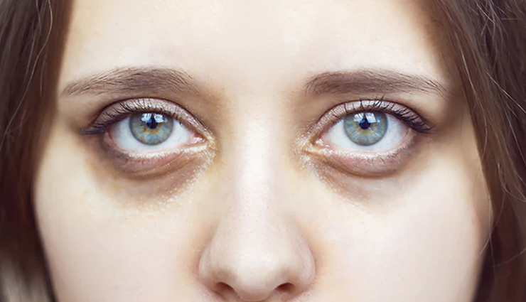 vitamin d deficiency skin problems,effects of low vitamin d on skin,vitamin d and acne breakouts,hair issues from vitamin d deficiency,signs of vitamin d deficiency on skin,vitamin d deficiency and aging,how vitamin d affects nails and skin