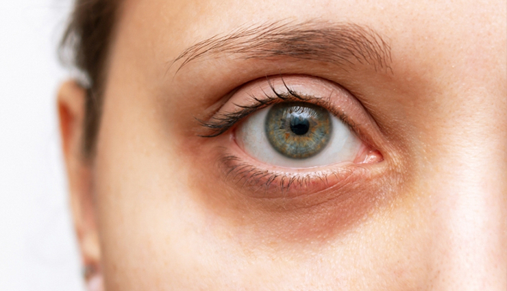 common beauty problems women face,beauty issues for women,skin problems women experience,hair problems for women,beauty struggles women encounter,common skincare concerns,hair care problems,facial skincare issues,acne and pimples in women,dry skin problems,oily skin issues for women,pigmentation problems women face,dandruff issues in women,wrinkles and fine lines,under-eye dark circles,hair thinning in women,skin redness and irritation,uneven skin tone problems,cracked heels and dry feet,body odor issues in women,hair frizz problems,common beauty challenges