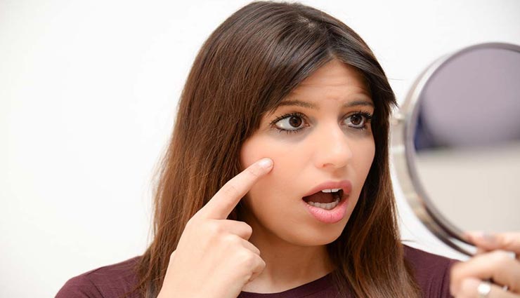 गर्मियों में काले घेरे घटाते हैं आँखों की सुंदरता, इन उपायों की मदद से दूर होगी यह समस्या