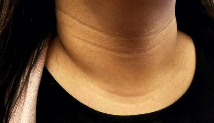 beetroot juice,beetroot juice good for skin,beetroot juice skin benefits,healthy food for skin,beetroot juice benefits,beetroot juice skin care tips,skin,skin care tips,beauty,beauty tips