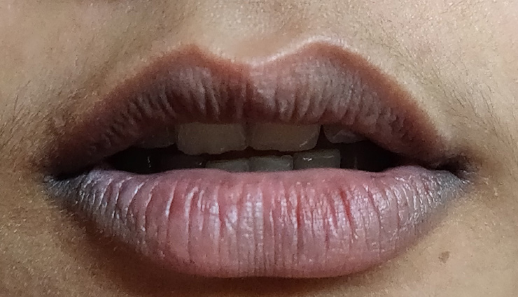 होठों को काला बनाती है ये 5 चीजें, पिंक लिप्स पाने के लिए करे ये घरेलू उपाय