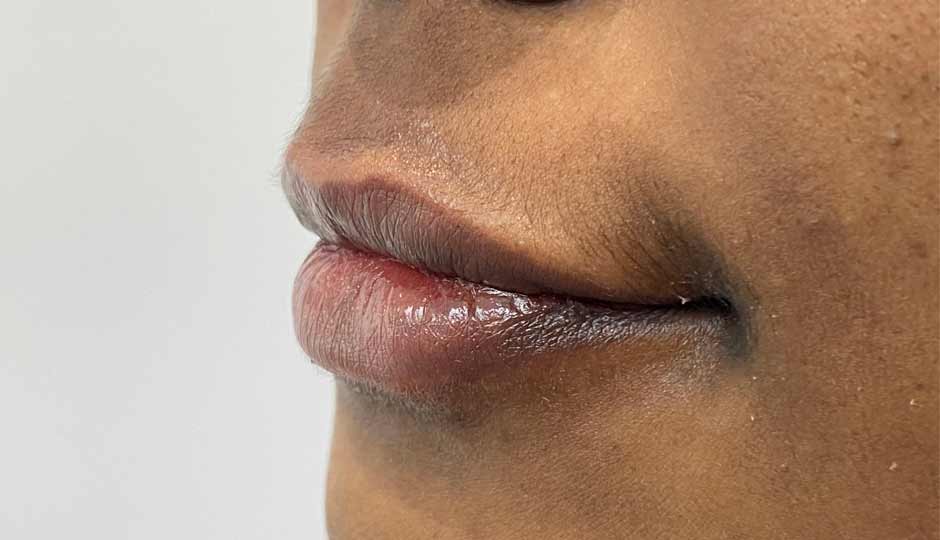 6 Home Remedies for Dark Lips