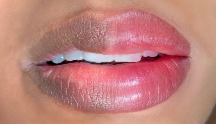 7 Home Remedies To Get Rid of Pigmented Lips Due To Smoking