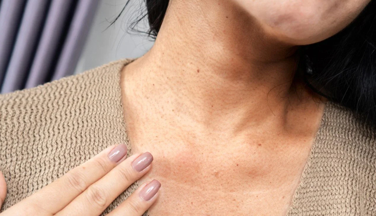 effective home remedies,dark neck treatment,natural remedies for dark neck,hyperpigmentation solutions,lighten neck skin,home remedies for skin discoloration,acanthosis nigricans treatment,neck skin brightening,treating dark neck naturally,skincare tips for dark neck,dark neck solutions,home treatments for uneven skin tone