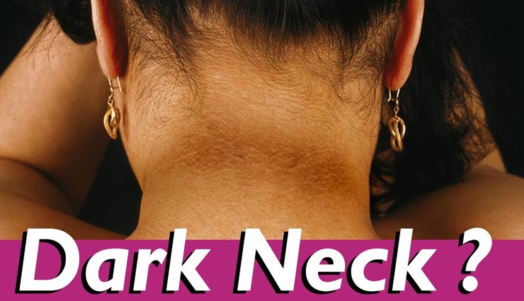 इन आसान तरीकों से दूर होगा गर्दन का कालापन, जानें और आजमाए