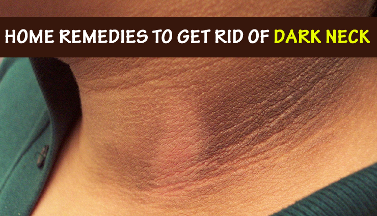 Home Remedies To Get Rid of Dark Neck
