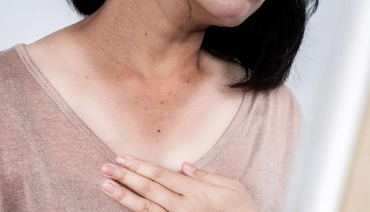 8 Effective Home Remedies to Treat Dark Neck