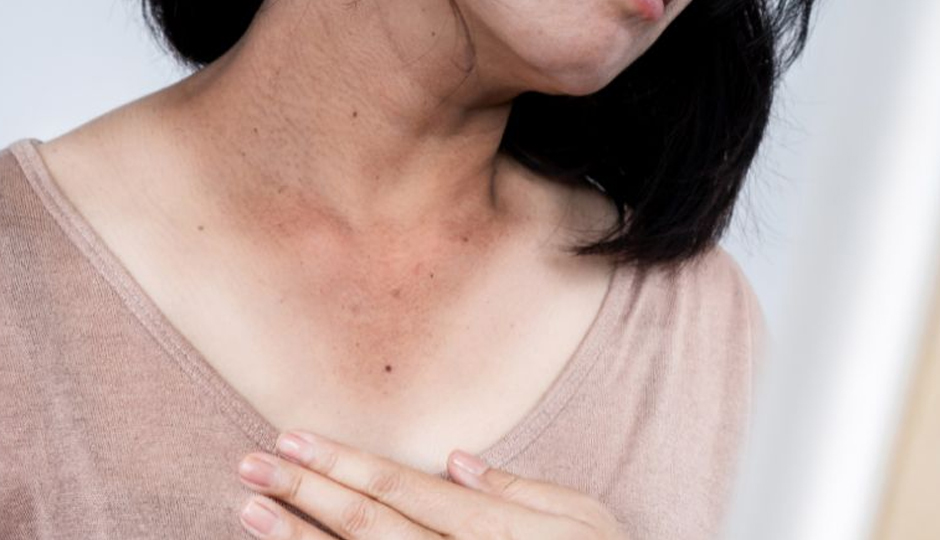 5 DIY Ways To Treat Dark Neck