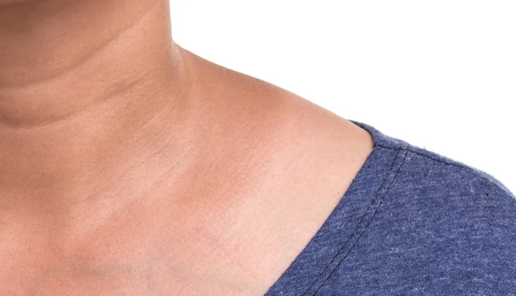 effective home remedies,dark neck treatment,natural remedies for dark neck,hyperpigmentation solutions,lighten neck skin,home remedies for skin discoloration,acanthosis nigricans treatment,neck skin brightening,treating dark neck naturally,skincare tips for dark neck,dark neck solutions,home treatments for uneven skin tone