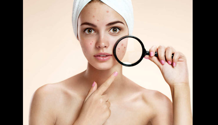 dark spots,face packs for dark spots,home remedies to treat dark spots,skin care tips,beauty tips