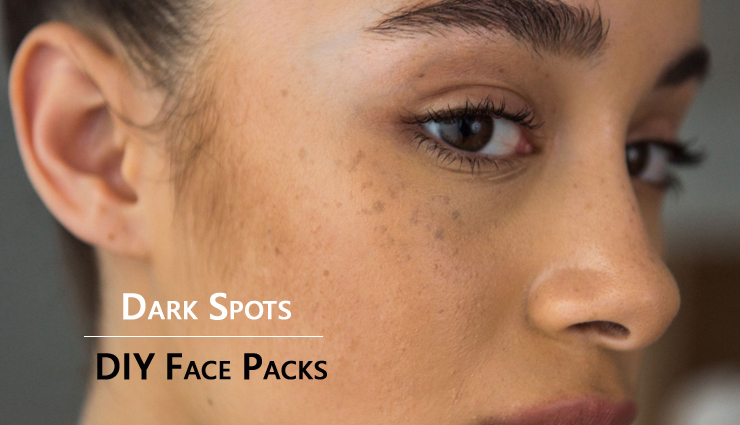 10 DIY Face Mask To Get Rid of Dark Spots
