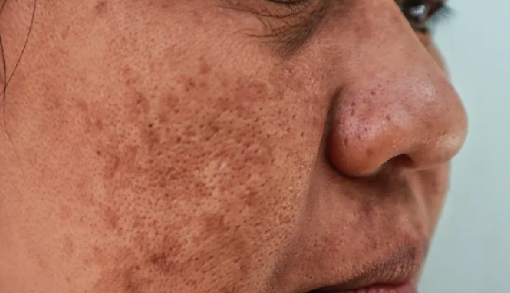 papaya benefits for skin and hair,reasons to use papaya for skin and hair,papaya effects on skin and hair,papaya for healthy skin and hair,natural benefits of papaya for skin and hair,papaya impact on skin and hair health,papaya beauty benefits for skin and hair,papaya skincare and haircare benefits,using papaya for skin and hair health,papaya role in enhancing skin and hair