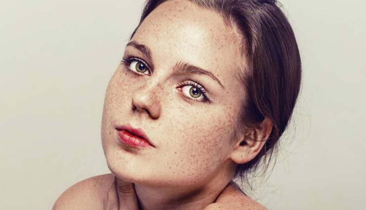 dark spots on face,home remedies for dark spots on face,home remedies,skin care tips,beauty tips