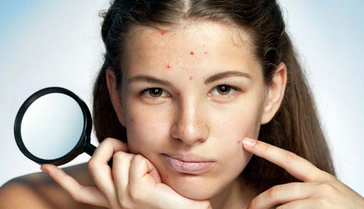 dark spots on face,home remedies for dark spots on face,home remedies,skin care tips,beauty tips