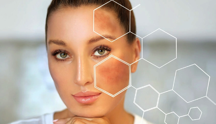 astaxanthin for skin,skin benefits of astaxanthin,astaxanthin skincare,astaxanthin supplements,natural skin care,antioxidant for skin,anti-aging properties of astaxanthin,astaxanthin for radiant skin,skin health with astaxanthin