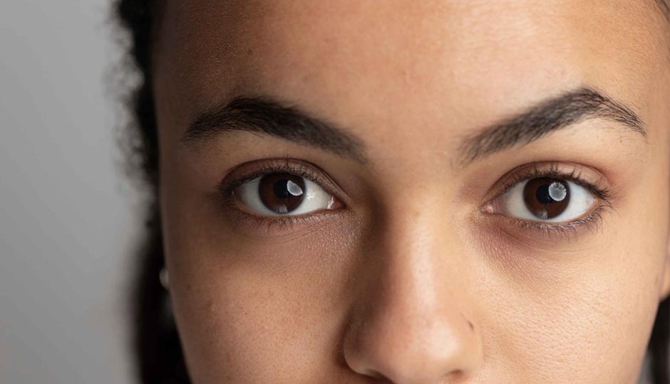 10 DIY Ways To Treat Dark Under Eyes
