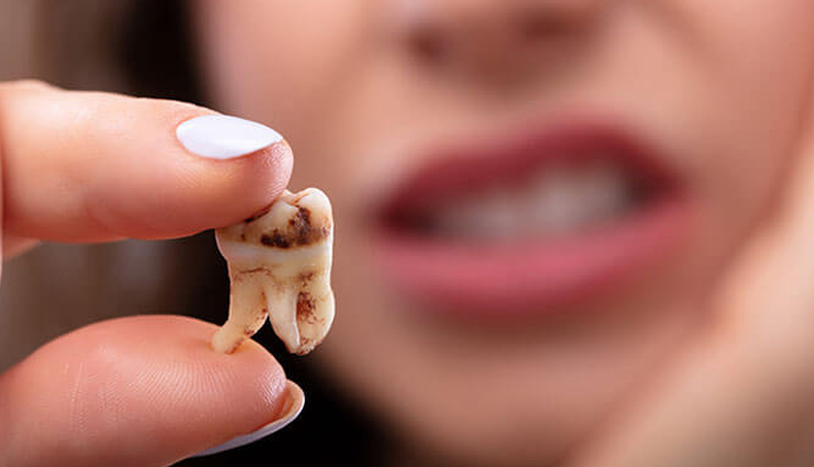 harmful effects of eating dates,dates,side effects of dates,Health tips,fitness tips