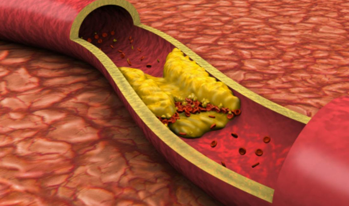 eat dates to stay healthy in winter you will get these great benefits,Health,healthy living