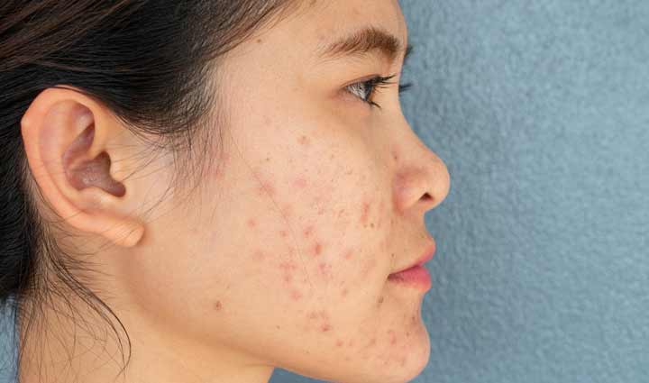 least known beneifts of dates for skin and hair,beauty tips,beauty hacks