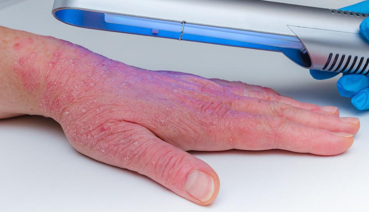 health benefits of dead sea salt,dead sea salt,Health tips,fitness tips