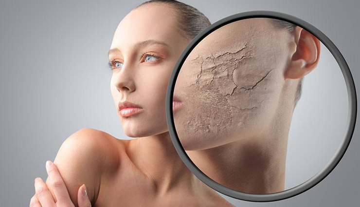 6 Home Remedies To Remove Dead Skin Cells
