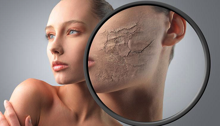 masoor dal face masks,diy masoor dal recipes,masoor dal skincare benefits,natural face masks with masoor dal,red lentil face masks,homemade masoor dal skincare,masoor dal for glowing skin,diy masoor dal beauty treatments,red lentil face packs,masoor dal skincare secrets