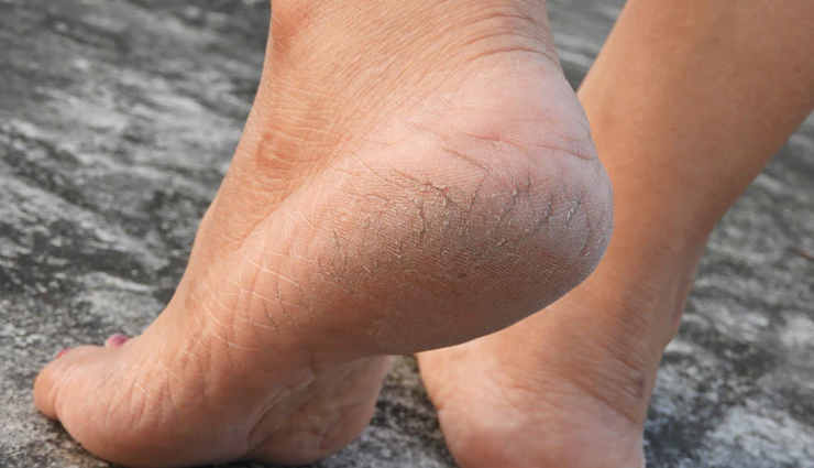 benefits of epsom salt foot soaks,amazing effects of epsom foot baths,how epsom foot soaks improve health,epsom salt foot soak advantages,stress relief with epsom foot soaks,relaxation benefits of epsom foot baths,calming effects of epsom salt foot soaks,epsom foot soaks for relaxation,epsom foot soaks for muscle pain,relief from sore feet with epsom salt,epsom foot baths for muscle relaxation,soothing sore muscles with epsom foot soaks,enhanced circulation with epsom foot soaks,benefits of epsom salt foot baths on blood flow,epsom foot soaks and cardiovascular health,improving circulation with epsom foot baths,epsom foot soaks for foot health,benefits of epsom salt for feet,epsom foot baths and foot care,healthy feet with epsom foot soaks,detoxifying effects of epsom foot soaks,cleansing the body with epsom salt foot baths,epsom foot soaks for body detox,removing toxins with epsom salt foot baths