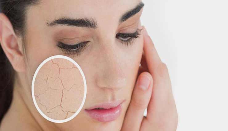 गर्मियों के दिनों में खोने लगती है चेहरे की रौनक, इसे पाने के लिए आजमाए ये 6 तरीके