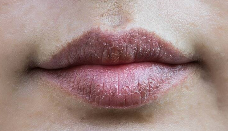 lips,lips care,dark lips care,pink lips,pink lips care,tips to get pink lips,beauty,beauty tips