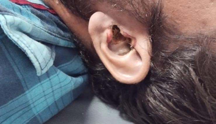 जयपुर : युवक के कान में फट गया ब्लूटूथ ईयरफोन और बहने लगा खून, कार्डियक अरेस्ट से गई जान