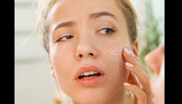 dehydrated skin,skin care tips,beauty tips,signs of skin dehydration