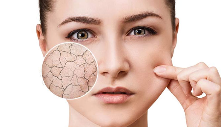 5 Signs That Show Your Skin is Dehydrated
