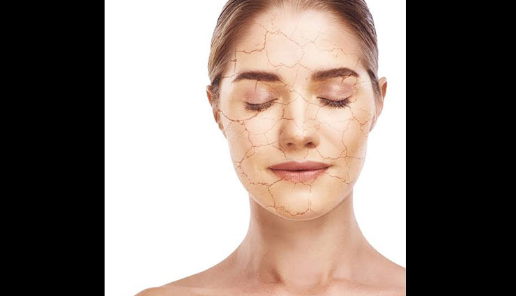 5 Signs That Show Your Skin is Dehydrated