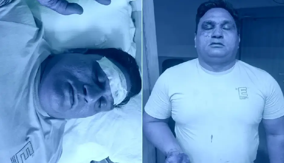 दिल्ली में बेखौफ बदमाशों का पुलिस टीम पर जानलेवा हमला, चाकू से वार में दो पुलिसकर्मी घायल, आरोपी मौके से फरार