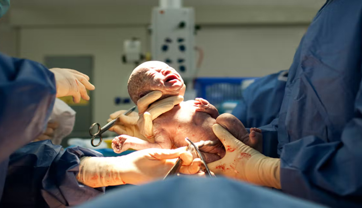 types of baby delivery methods every mom to be should know about,Health tips,healthy living