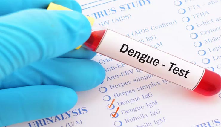 Health tips,health tips in hindi,dengue,dengue symptoms,dengue in corona time ,हेल्थ टिप्स, हेल्थ टिप्स हिंदी में, डेंगू, डेंगू से बचाव, कोरोनाकाल में डेंगू
