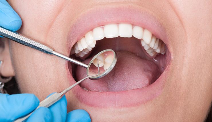 yogurt,health benefits of eating yogurt,yogurt health,yogurt health tips,yogurt health benefits,healthy benefits of yogurt,yogurt for good health,healthy food,healthy living