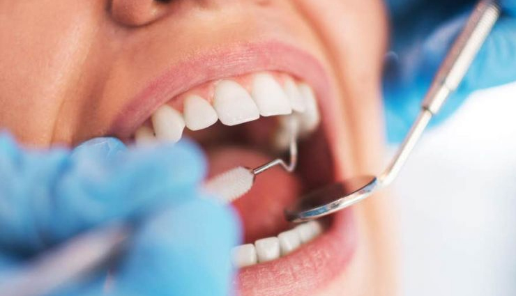 Tooth Trouble: The Worst Foods for Your Dental Health