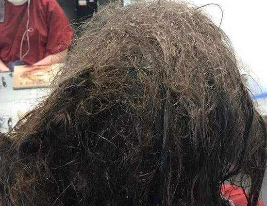 It Took 13 Hours to Fix The Hair Of Depressed Teen
