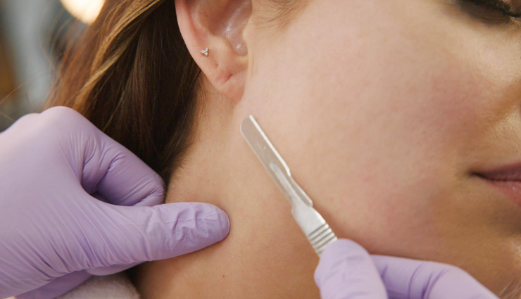 ways to remove facial hair at home,beauty tips,beauty hacks