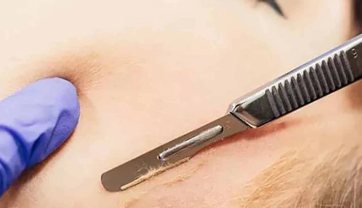 peach fuzz removal remedies,get rid of peach fuzz naturally,effective remedies for peach fuzz removal,peach fuzz removal at home,diy remedies to eliminate peach fuzz,best ways to get rid of peach fuzz,natural remedies for peach fuzz removal,peach fuzz removal techniques,home remedies for smooth skin without peach fuzz,tips to remove peach fuzz effectively