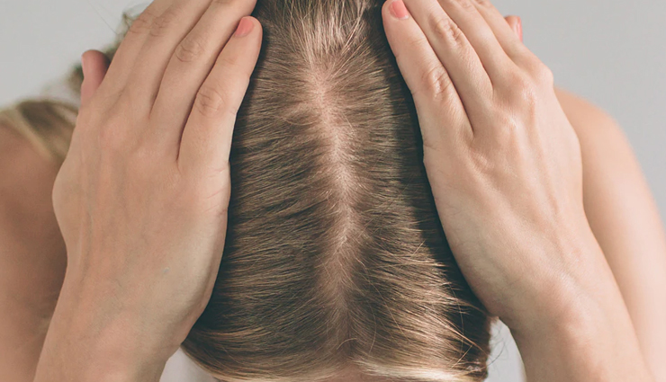 ways to detox your scalp,scalp care tips,hair care tips,beauty tips