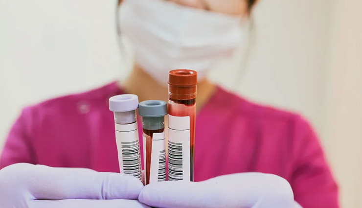 diabetes,tips to manage diabetes,diabetes care tips,Health tips,fitness tips