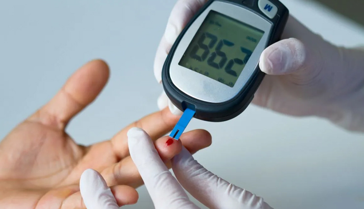 World Stroke Day 2022: याद कर लें ये लक्षण, स्ट्रोक से पहले दिमाग देता है इशारे world stroke day 2022,brain stroke,brain stroke symptoms,Health,health news in hindi,healthy living